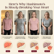 Illustration of Hashimoto's progression stages and related thyroid health concerns in women