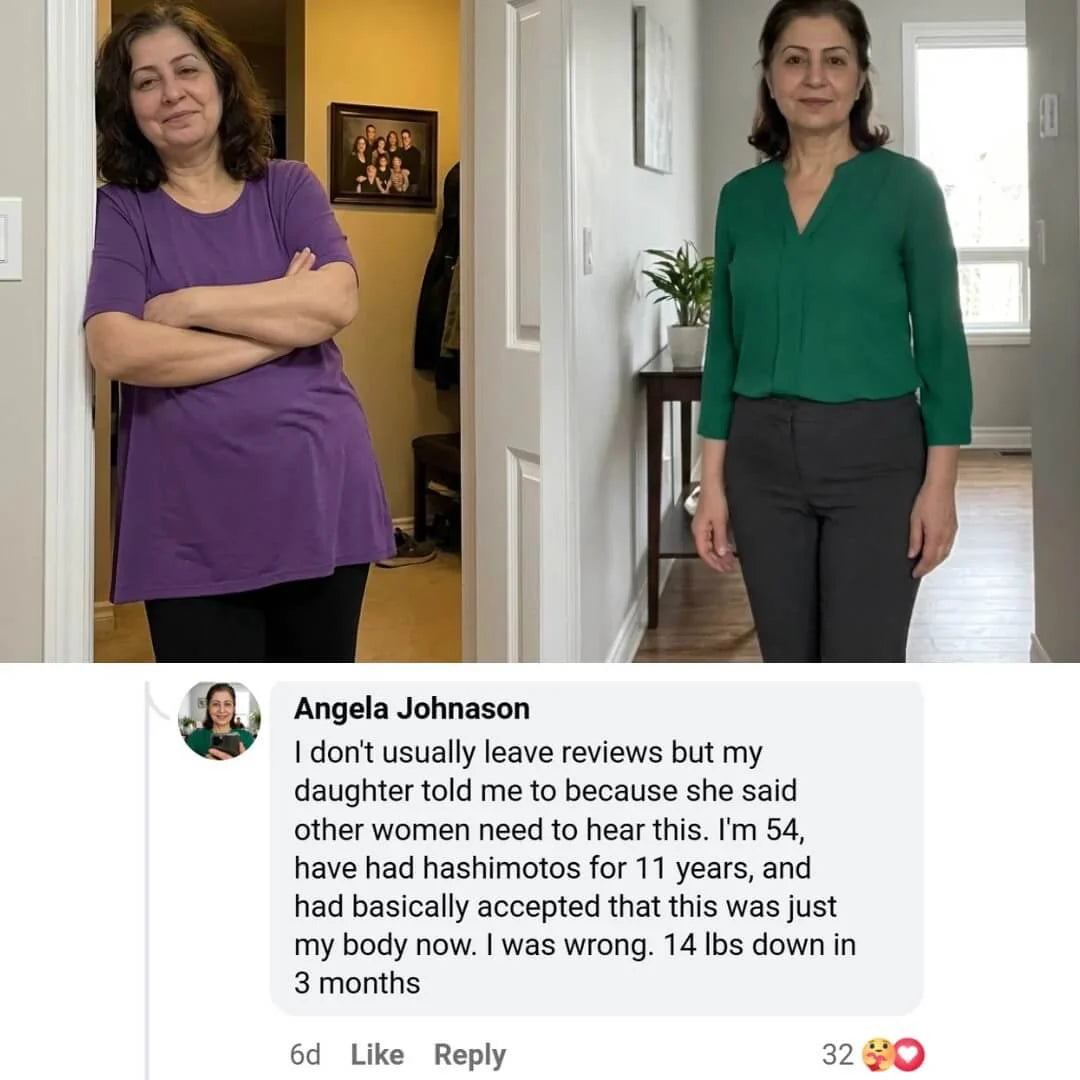 Nourveen thyroid support customer progress photo 10